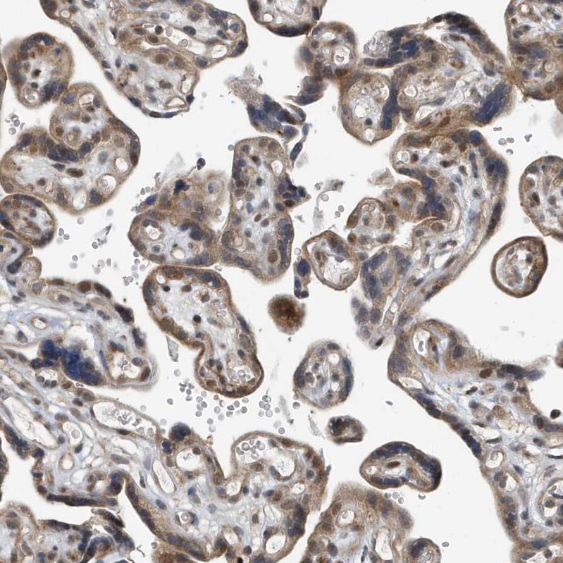 KIF15 Antibody - BSA Free Immunohistochemistry-Paraffin: KIF15 Antibody - BSA Free [NBP1-83252]