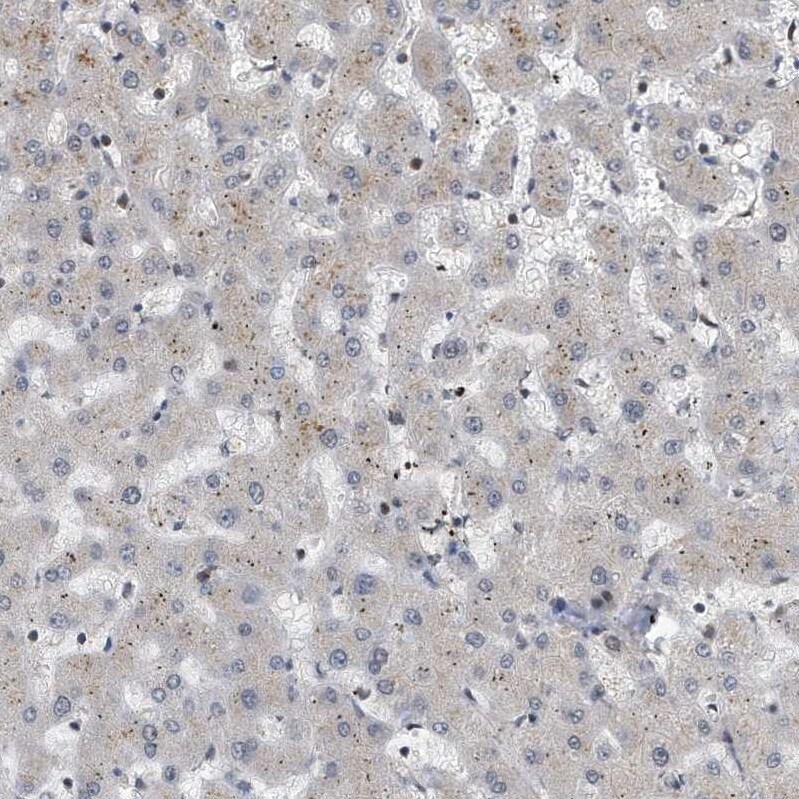 KIF15 Antibody - BSA Free Immunohistochemistry-Paraffin: KIF15 Antibody - BSA Free [NBP1-83252]