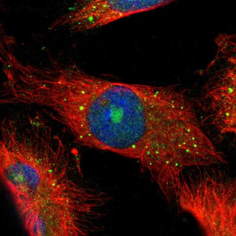 CBS Antibody - BSA Free Immunocytochemistry/ Immunofluorescence: CBS Antibody [NBP1-83255]