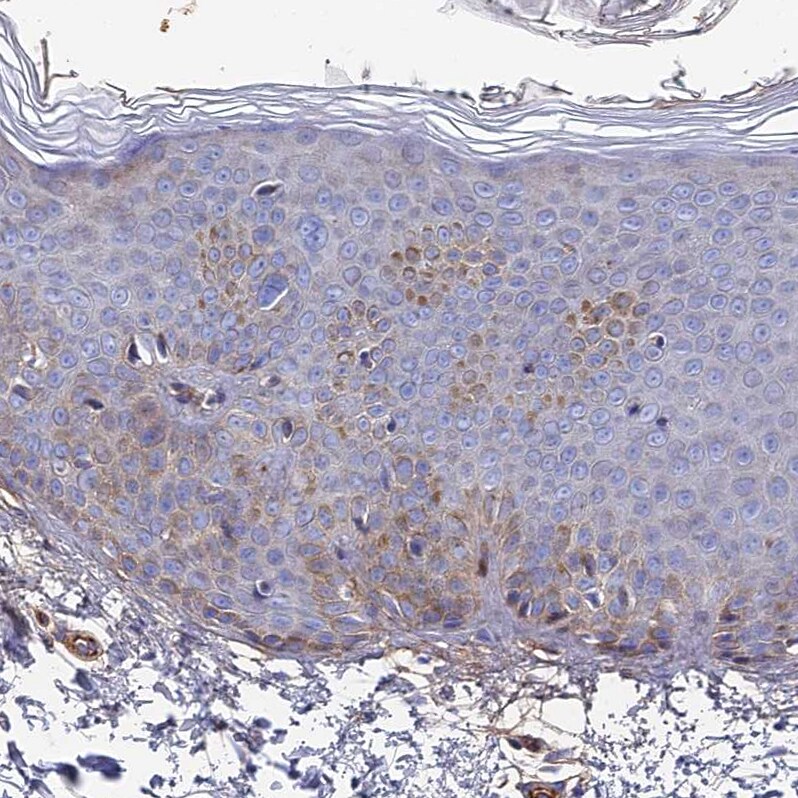 GPR113 Antibody - BSA Free Immunohistochemistry-Paraffin: GPR113 Antibody - BSA Free [NBP1-83262]