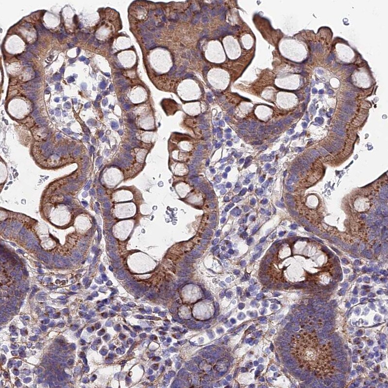 GPR113 Antibody - BSA Free Immunohistochemistry-Paraffin: GPR113 Antibody - BSA Free [NBP1-83262]