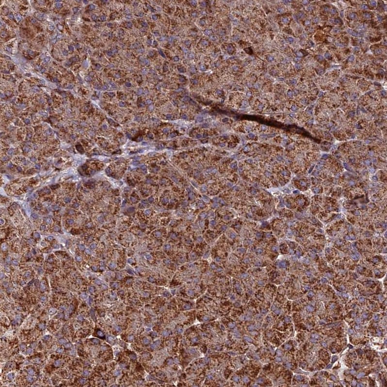 HERPUD1 Antibody - BSA Free Immunohistochemistry-Paraffin: HERPUD1 Antibody - BSA Free [NBP1-83267]