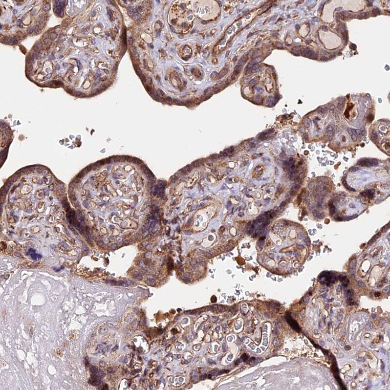 HERPUD1 Antibody - BSA Free Immunohistochemistry-Paraffin: HERPUD1 Antibody - BSA Free [NBP1-83267]