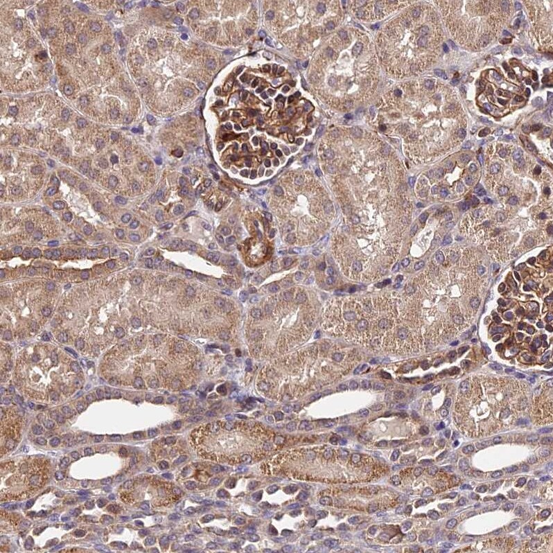 HERPUD1 Antibody - BSA Free Immunohistochemistry-Paraffin: HERPUD1 Antibody - BSA Free [NBP1-83267]