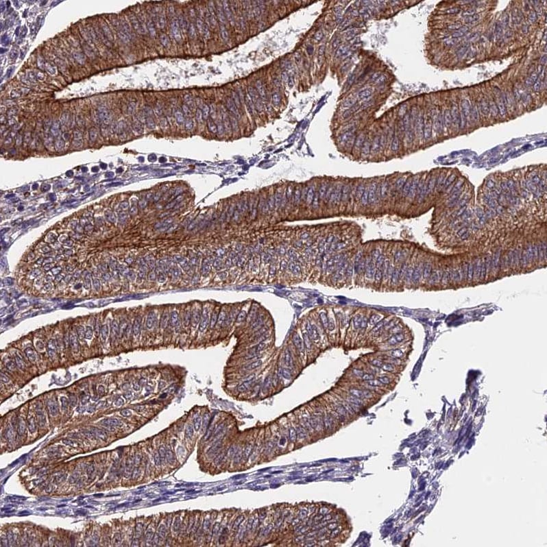 HERPUD1 Antibody - BSA Free Immunohistochemistry-Paraffin: HERPUD1 Antibody - BSA Free [NBP1-83267]