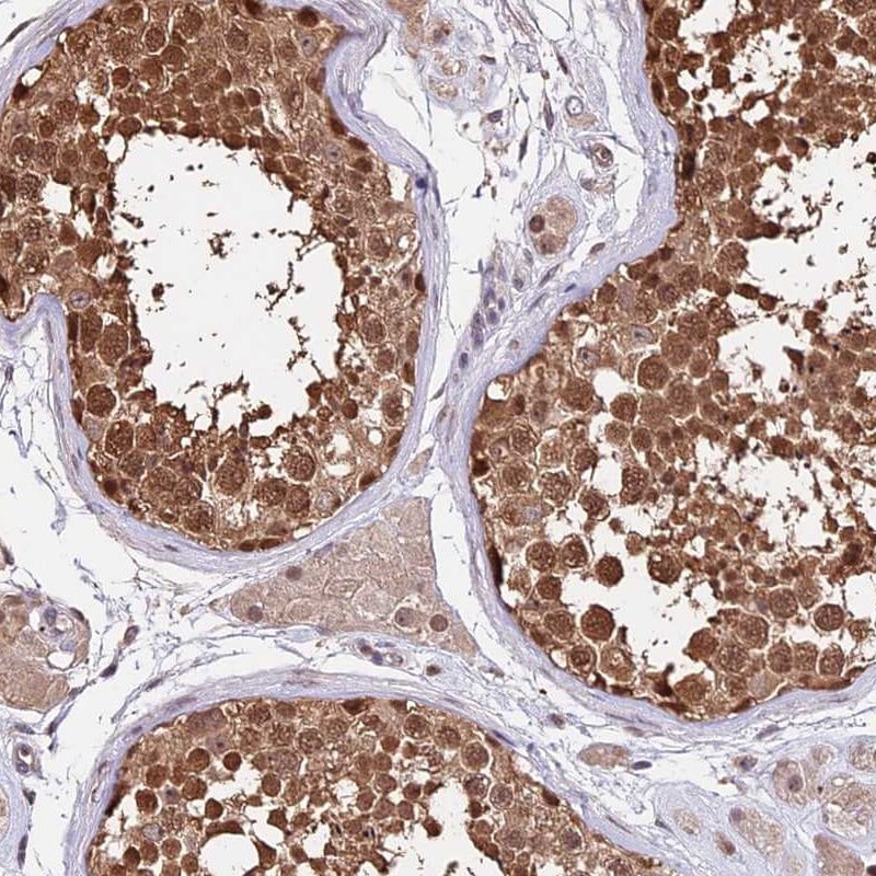 HERPUD1 Antibody - BSA Free Immunohistochemistry: HERPUD1 Antibody - BSA Free [NBP1-83268]