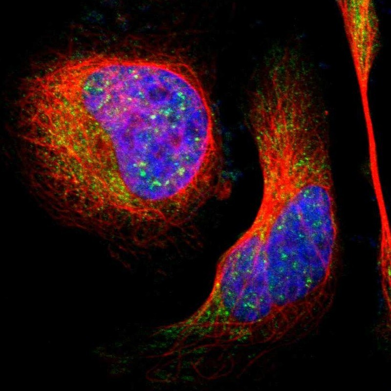 LHPP Antibody - BSA Free Immunocytochemistry/ Immunofluorescence: LHPP Antibody [NBP1-83272]