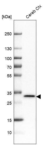 LHPP Antibody - BSA Free Western Blot: LHPP Antibody - BSA Free [NBP1-83272]