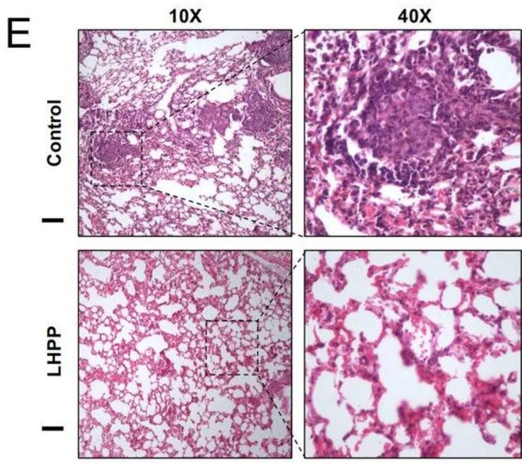 LHPP Antibody