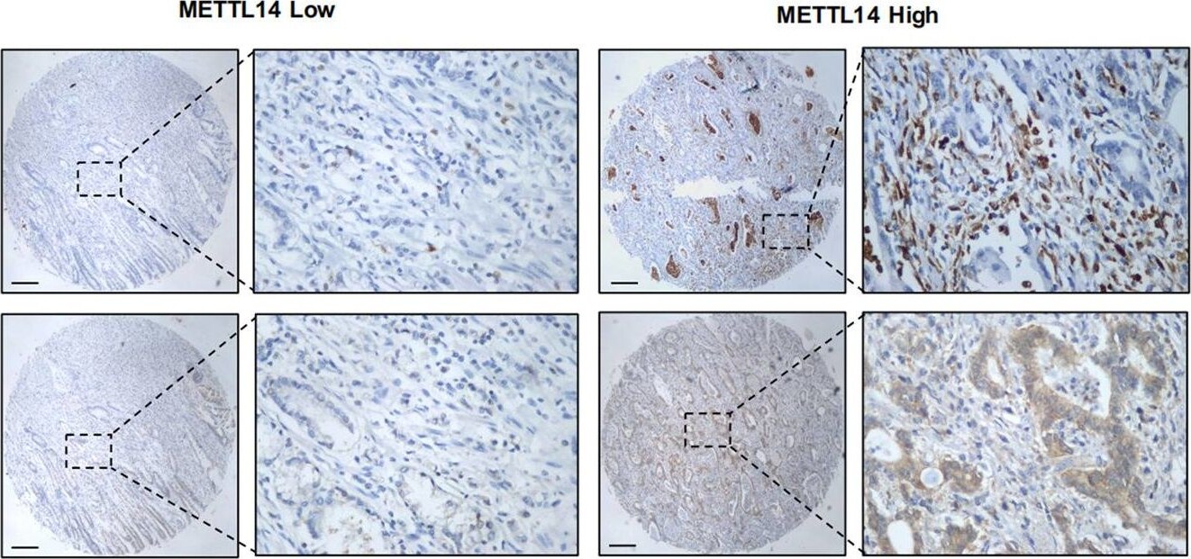 LHPP Antibody