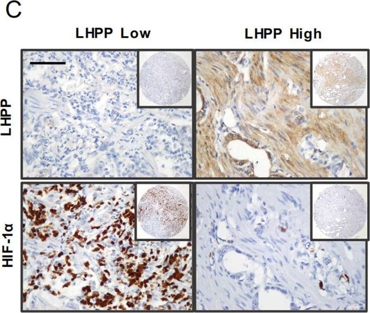 LHPP Antibody