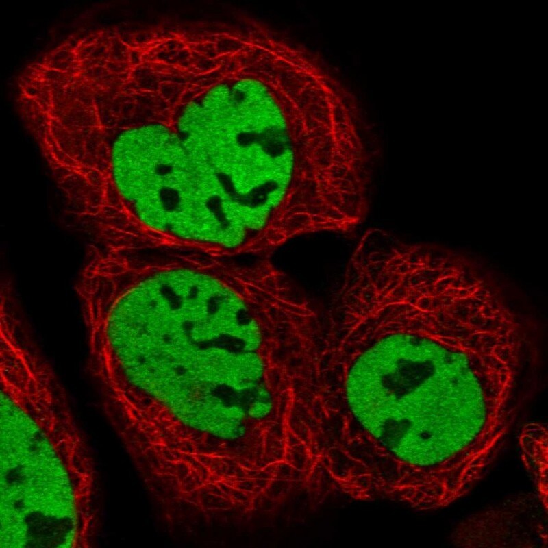 HDAC9 Antibody - BSA Free Immunocytochemistry/ Immunofluorescence: HDAC9 Antibody [NBP1-83274]
