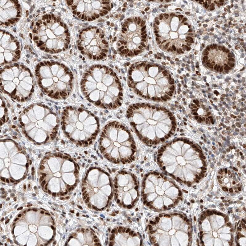 HDAC9 Antibody - BSA Free Immunohistochemistry-Paraffin: HDAC9 Antibody - BSA Free [NBP1-83274]