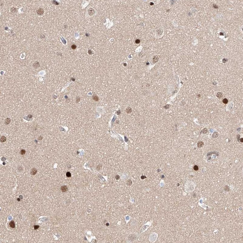 HDAC9 Antibody - BSA Free Immunohistochemistry-Paraffin: HDAC9 Antibody - BSA Free [NBP1-83274]