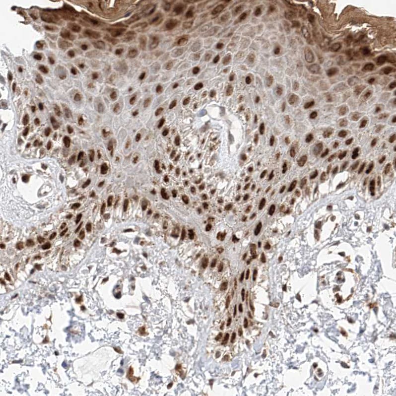 HDAC9 Antibody - BSA Free Immunohistochemistry-Paraffin: HDAC9 Antibody - BSA Free [NBP1-83274]