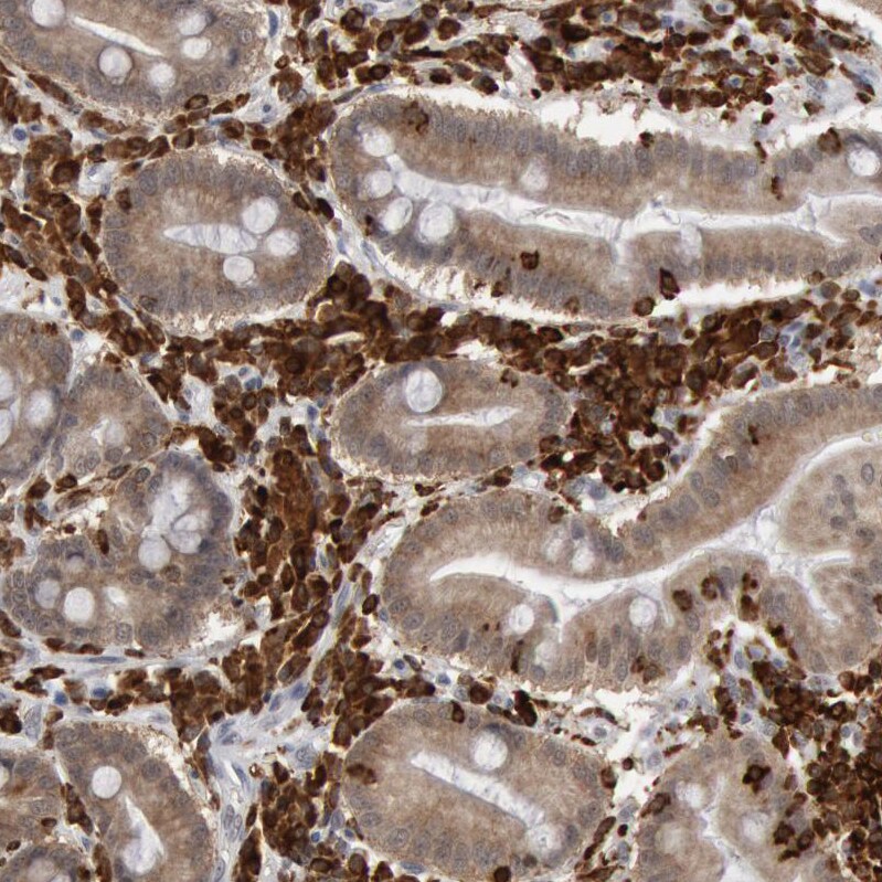 SHP-1 Antibody - BSA Free Immunohistochemistry-Paraffin: SHP-1 Antibody - BSA Free [NBP1-83276]