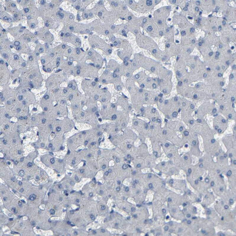 NMES1 Antibody Immunohistochemistry-Paraffin: NMES1 Antibody [NBP2-31996]