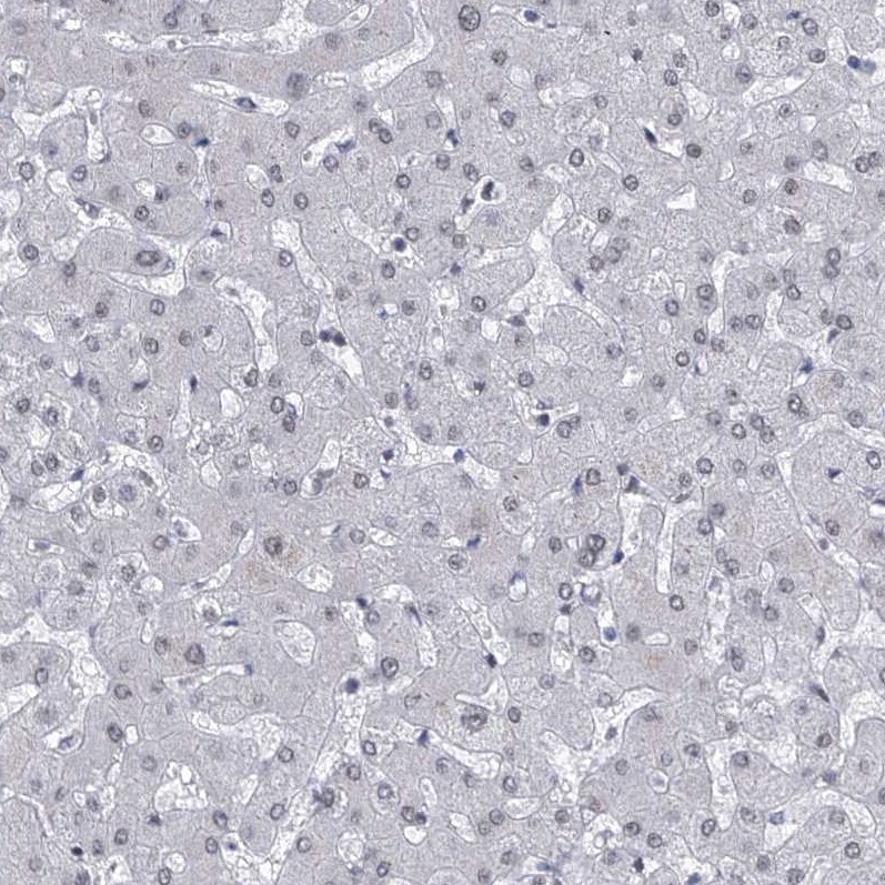 Centrin 2 Antibody Immunohistochemistry-Paraffin: Centrin 2 Antibody [NBP1-88213]