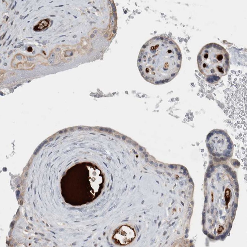 TRIM26 Antibody Immunohistochemistry-Paraffin: TRIM26 Antibody [NBP1-83909]