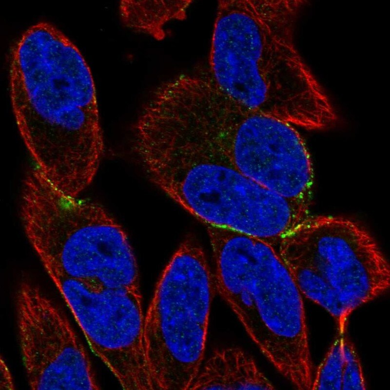 BVES Antibody - BSA Free Immunocytochemistry/ Immunofluorescence: BVES Antibody [NBP1-83286]