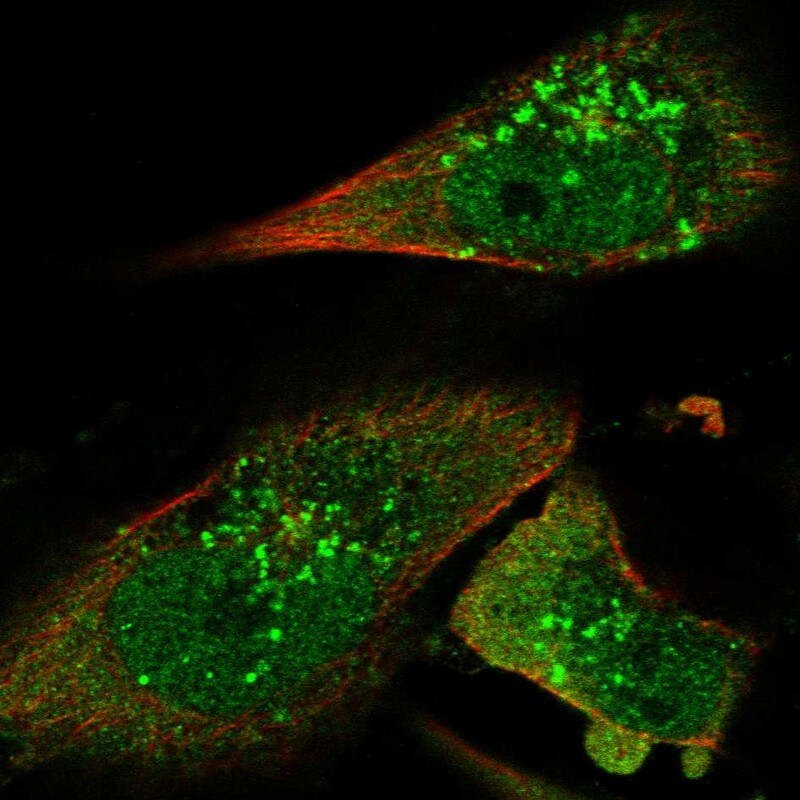 STAM2 Antibody - BSA Free Immunocytochemistry/ Immunofluorescence: STAM2 Antibody [NBP1-83288]