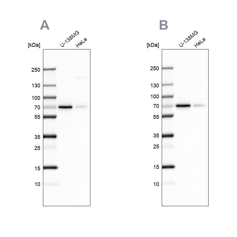 STAM2 Antibody - BSA Free Western Blot: STAM2 Antibody - BSA Free [NBP1-83289]