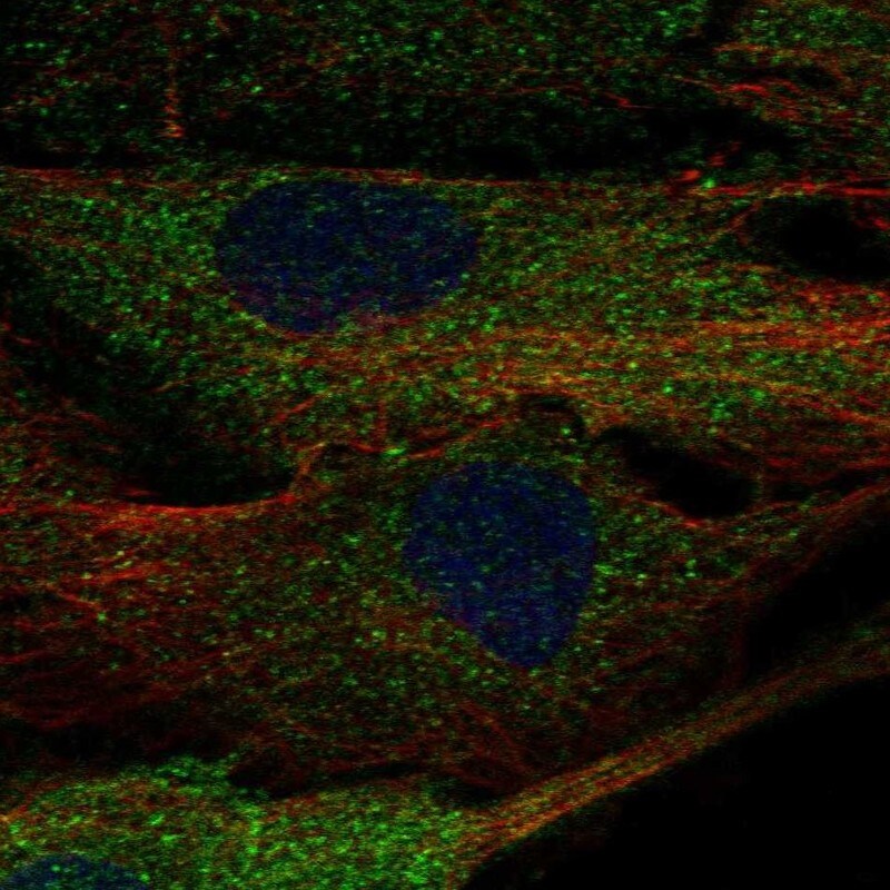 ALPK2 Antibody - BSA Free Immunocytochemistry/ Immunofluorescence: ALPK2 Antibody [NBP1-83295]
