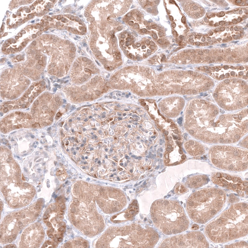 HAI-2/SPINT2 Antibody - BSA Free Immunohistochemistry-Paraffin: HAI-2/SPINT2 Antibody - BSA Free [NBP1-83299]