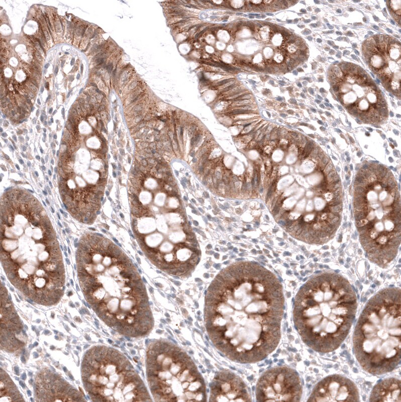 HAI-2/SPINT2 Antibody - BSA Free Immunohistochemistry-Paraffin: HAI-2/SPINT2 Antibody - BSA Free [NBP1-83299]