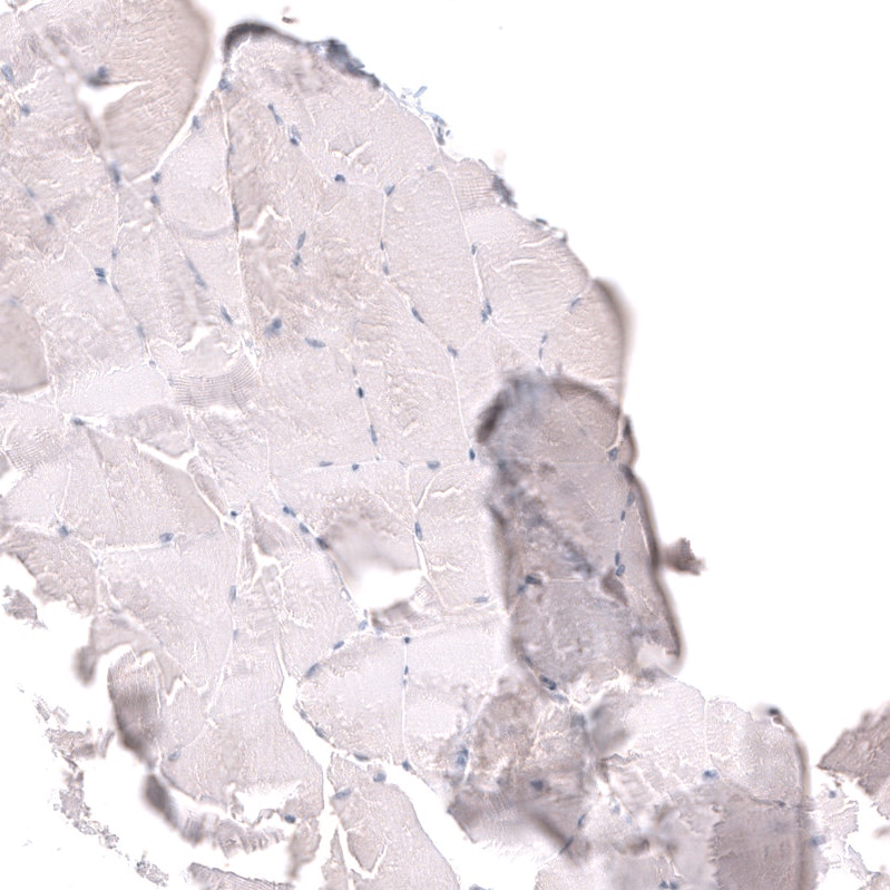 HAI-2/SPINT2 Antibody - BSA Free Immunohistochemistry-Paraffin: HAI-2/SPINT2 Antibody - BSA Free [NBP1-83299]