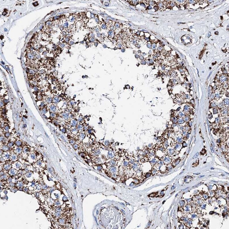HADH Antibody - BSA Free Immunohistochemistry-Paraffin: HADH Antibody - BSA Free [NBP1-83300]
