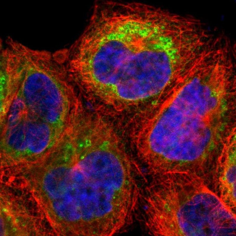 NSDHL Antibody - BSA Free Immunocytochemistry/ Immunofluorescence: NSDHL Antibody [NBP1-83307]