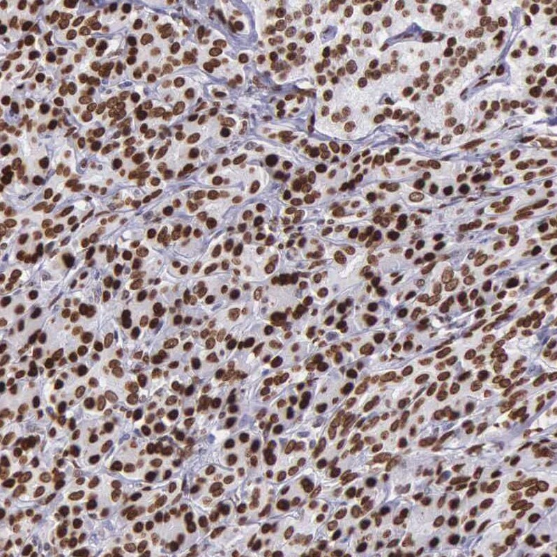 H1F0 Antibody - BSA Free Immunohistochemistry-Paraffin: H1F0 Antibody - BSA Free [NBP1-83308]