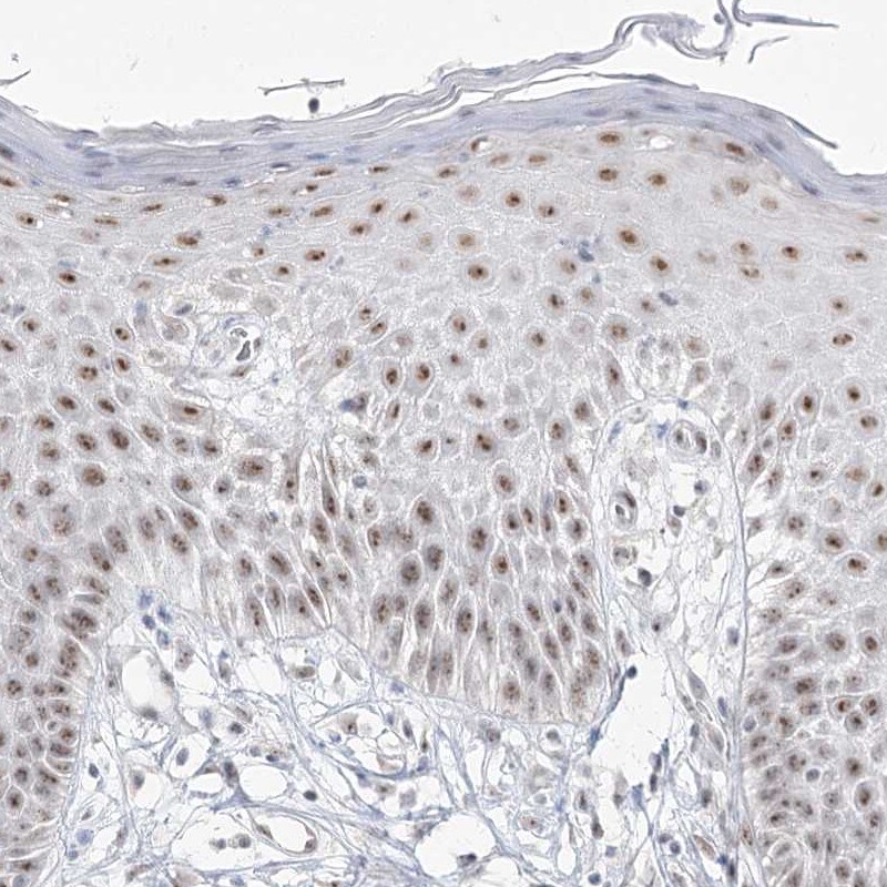 DDX50 Antibody - BSA Free Immunohistochemistry-Paraffin: DDX50 Antibody [NBP1-83311]