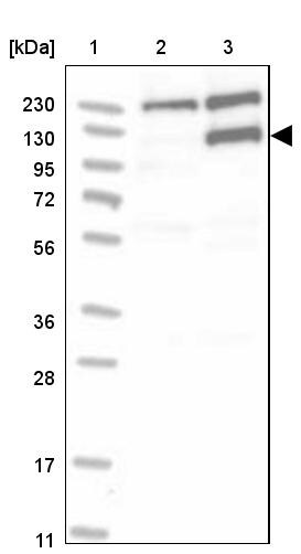 MSH6 Antibody - BSA Free Western Blot: MSH6 Antibody - BSA Free [NBP1-83319]