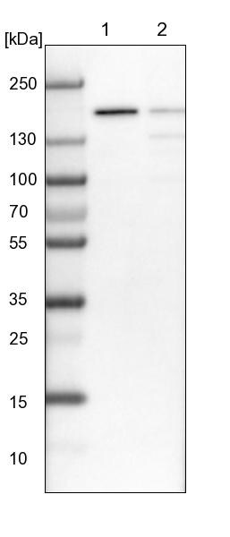 MSH6 Antibody - BSA Free Western Blot: MSH6 Antibody - BSA Free [NBP1-83319]