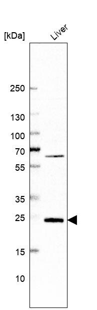 GSTZ1 Antibody - BSA Free Western Blot: GSTZ1 Antibody - BSA Free [NBP1-83320]