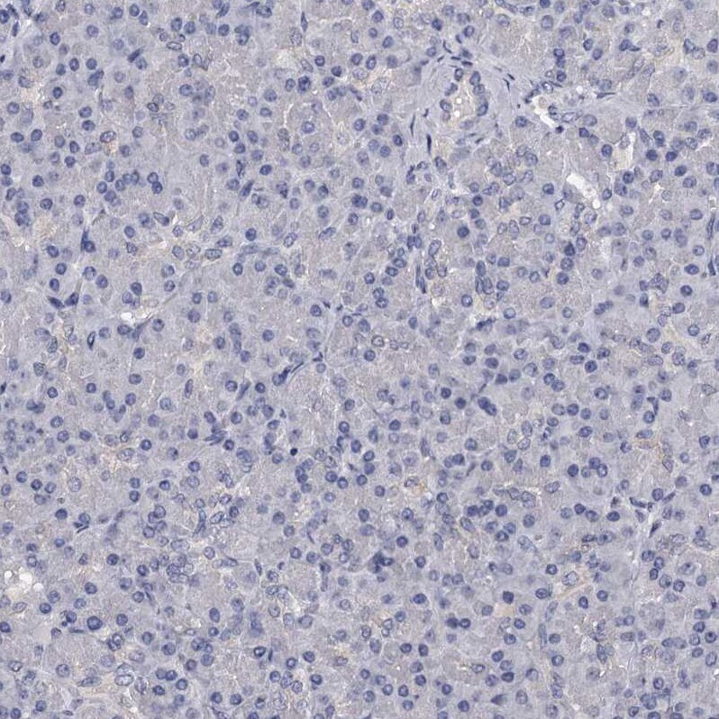 GSTO1 Antibody - BSA Free Immunohistochemistry-Paraffin: GSTO1 Antibody - BSA Free [NBP1-83321]