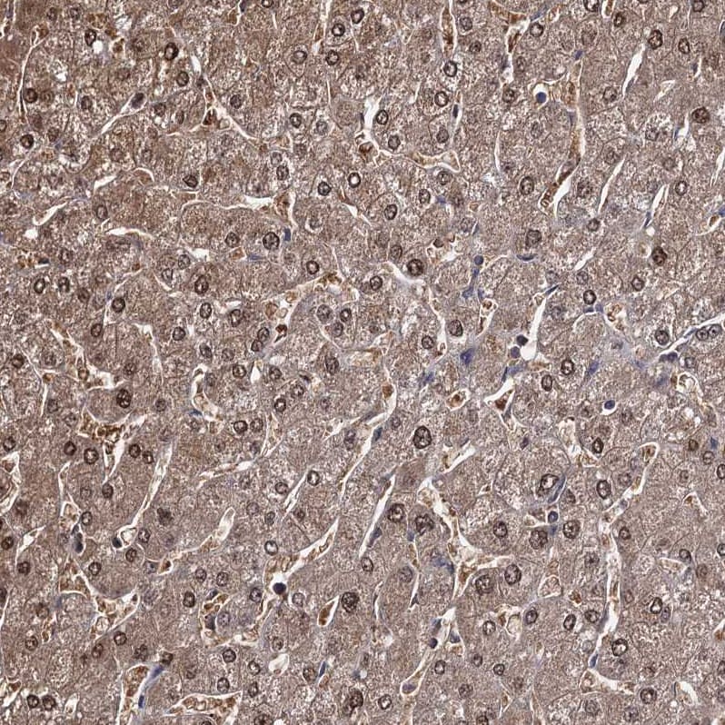 GSTO1 Antibody - BSA Free Immunohistochemistry-Paraffin: GSTO1 Antibody - BSA Free [NBP1-83321]