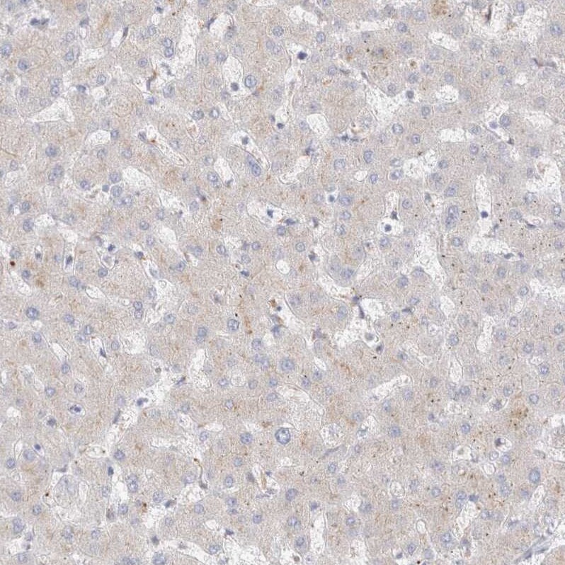 Hematopoietic Prostaglandin D Synthase/HPGDS Antibody - BSA Free Immunohistochemistry-Paraffin: Hematopoietic Prostaglandin D Synthase/HPGDS Antibody [NBP1-83322]