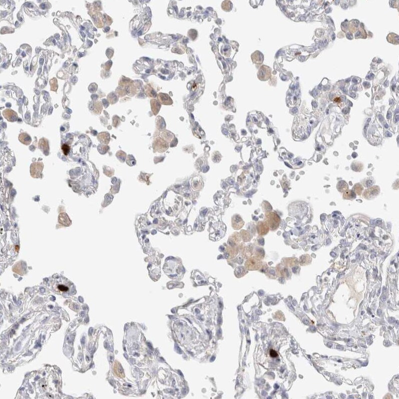 Hematopoietic Prostaglandin D Synthase/HPGDS Antibody - BSA Free Immunohistochemistry-Paraffin: Hematopoietic Prostaglandin D Synthase/HPGDS Antibody [NBP1-83322]
