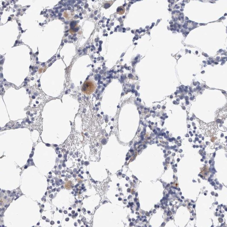 Hematopoietic Prostaglandin D Synthase/HPGDS Antibody - BSA Free Immunohistochemistry-Paraffin: Hematopoietic Prostaglandin D Synthase/HPGDS Antibody [NBP1-83322]
