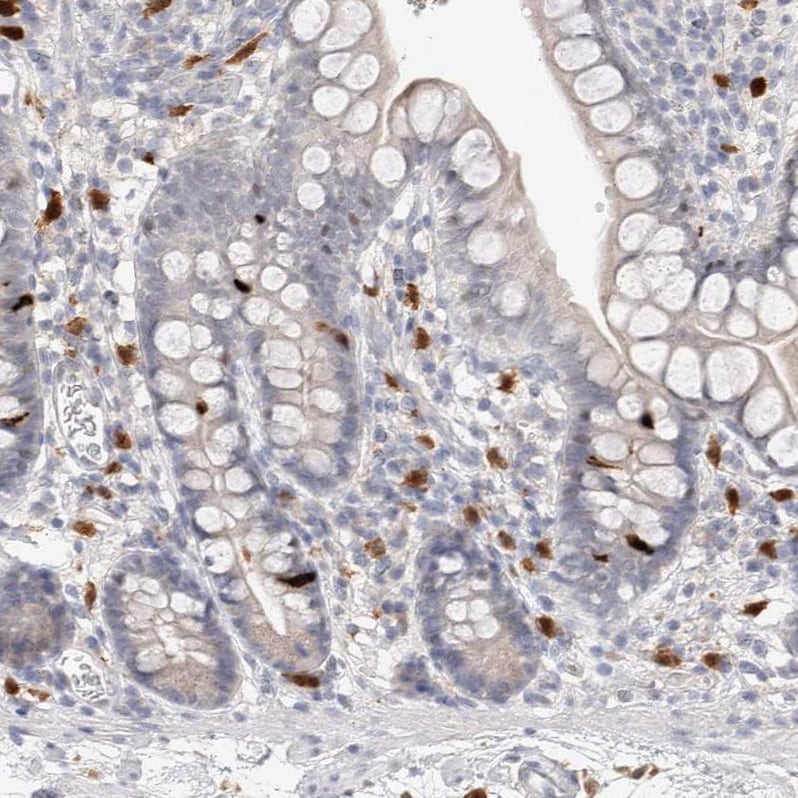 Hematopoietic Prostaglandin D Synthase/HPGDS Antibody - BSA Free Immunohistochemistry-Paraffin: Hematopoietic Prostaglandin D Synthase/HPGDS Antibody - BSA Free [NBP1-83322]