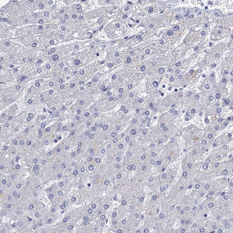 GSTM3 Antibody - BSA Free Immunohistochemistry-Paraffin: GSTM3 Antibody - BSA Free [NBP1-83323]