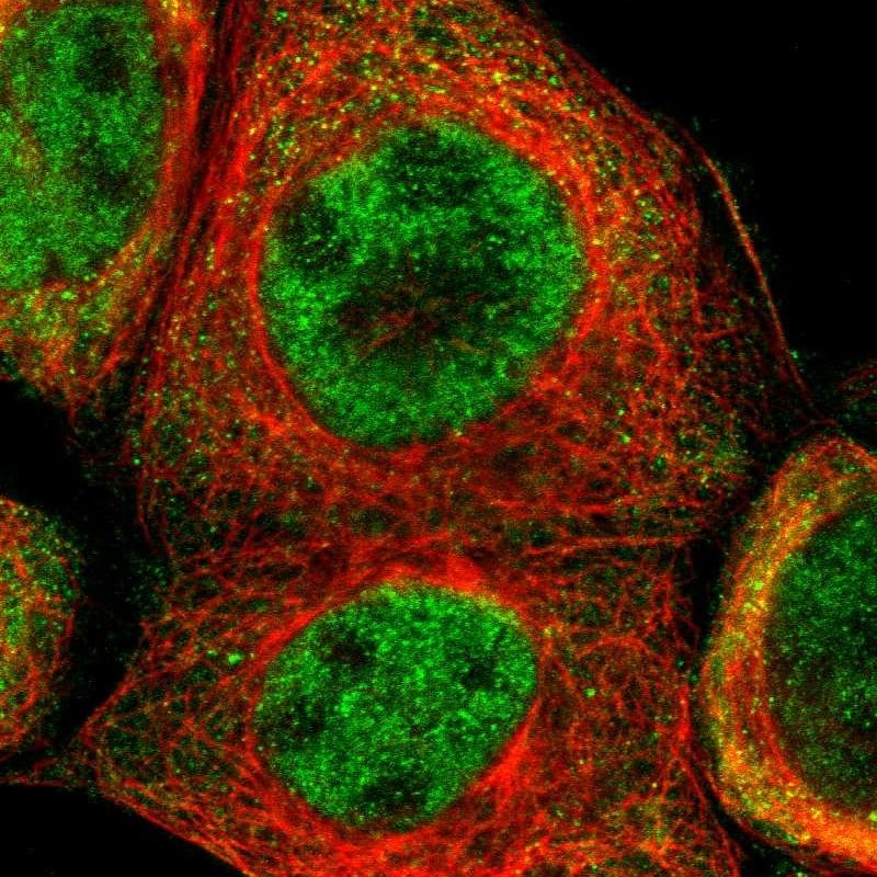 TRIB2 Antibody - BSA Free Immunocytochemistry/ Immunofluorescence: TRIB2 Antibody - BSA Free [NBP1-83326]