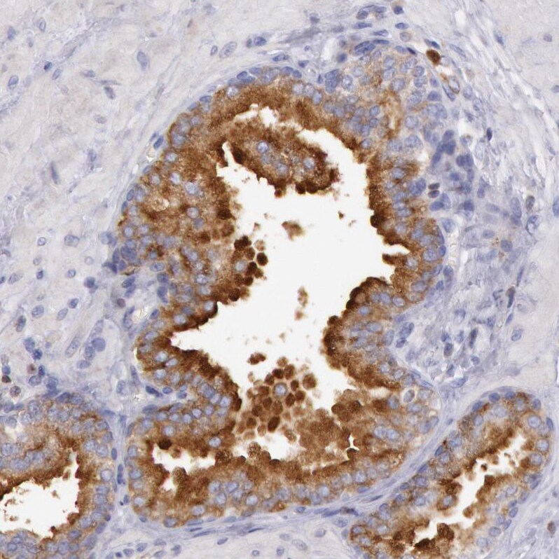 Rab27a Antibody - BSA Free Immunohistochemistry-Paraffin: Rab27a Antibody - BSA Free [NBP1-83327]