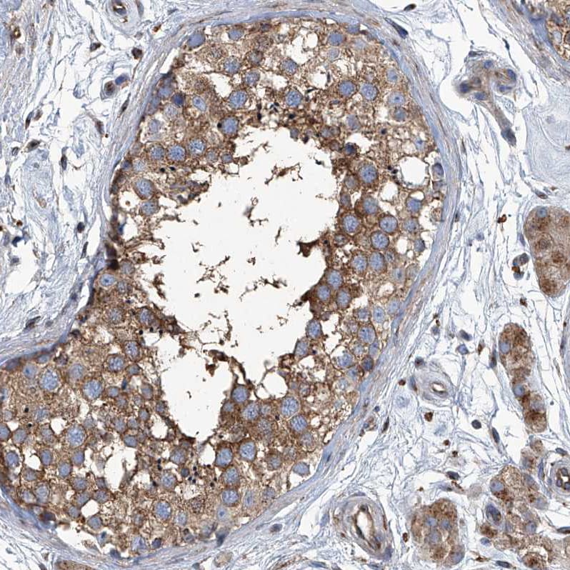 PIGH Antibody - BSA Free Immunohistochemistry-Paraffin: PIGH Antibody - BSA Free [NBP1-83342]