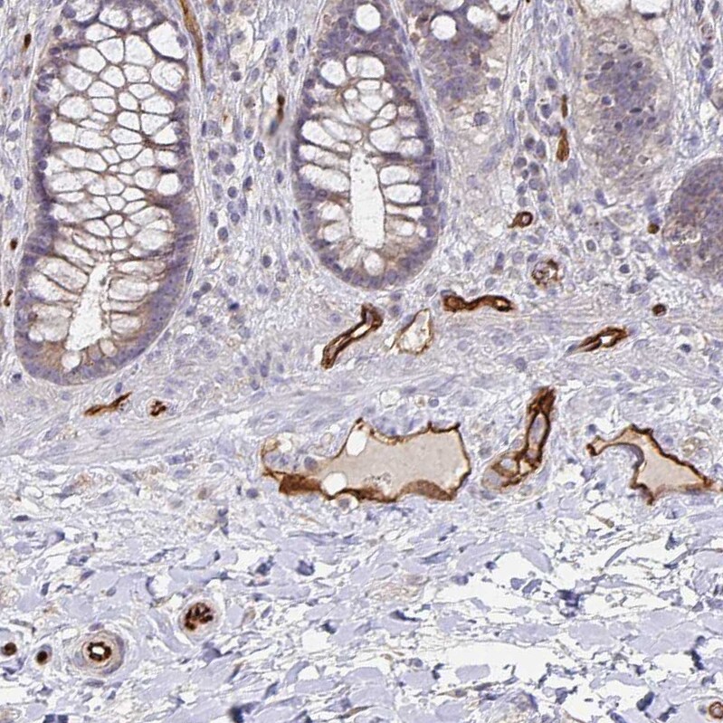 Podocalyxin Like Antibody - BSA Free Immunohistochemistry-Paraffin: Podocalyxin Like Antibody - BSA Free [NBP1-83348]