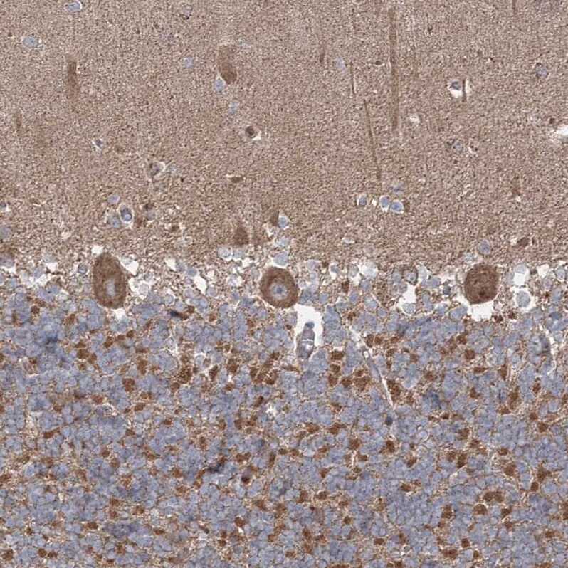 LRPPRC Antibody - BSA Free Immunohistochemistry-Paraffin: LRPPRC Antibody - BSA Free [NBP1-83349]