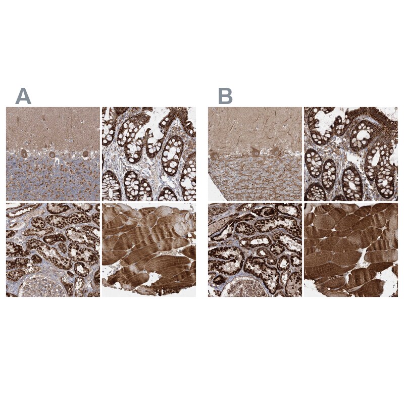 LRPPRC Antibody - BSA Free Immunohistochemistry-Paraffin: LRPPRC Antibody - BSA Free [NBP1-83349]